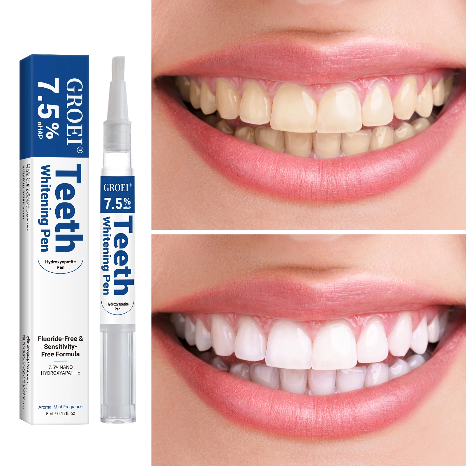 Hydroxyapatite Tooth Whitening - Teeth Whitening Near Me 评论和价格