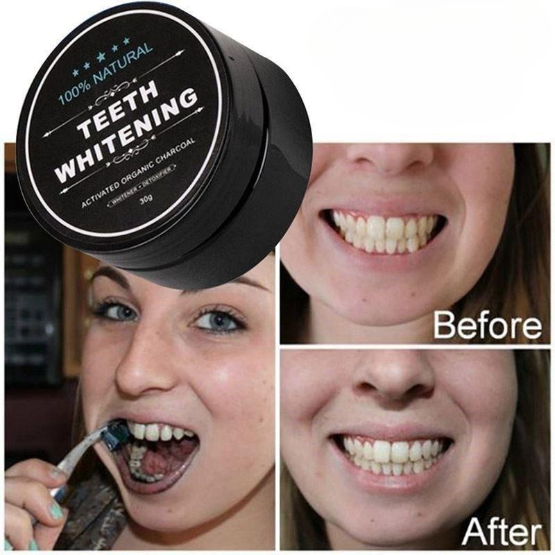 1 Box Activated Charcoal Teeth - Teeth Whitening Pens 评论和价格